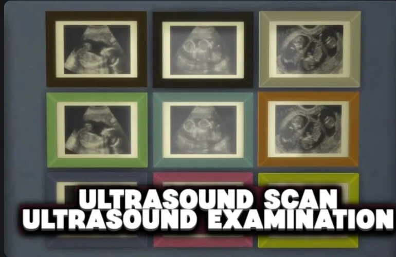 Ultrasound Scan Mod